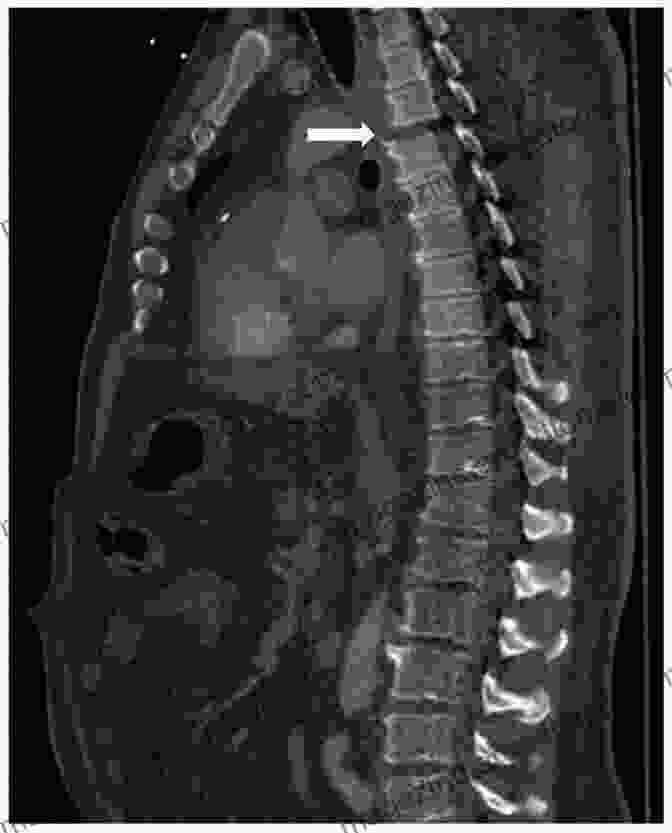 CT Scanner Capturing Thoracic Images Imaging Modalities For Biological And Preclinical Research: A Compendium Volume 1: Part I: Ex Vivo Biological Imaging (IOP Ebooks)