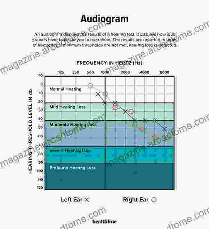 Example Of An Audiogram And Its Interpretation Listen Up : A Physician S Guide To Effectively Treating Your Hearing Loss