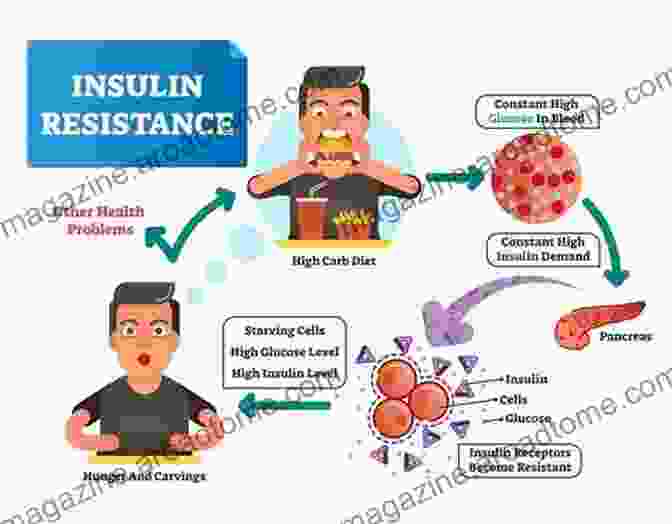 Insulin Resistance In Diabetes: A Comprehensive Guide The Diabetic Brain In Alzheimer S Disease: How Insulin Resistance In Type 2 Diabetes And Type 3 Diabetes Triggers Your Risk For Alzheimer S And How You Can Protect Your Brain