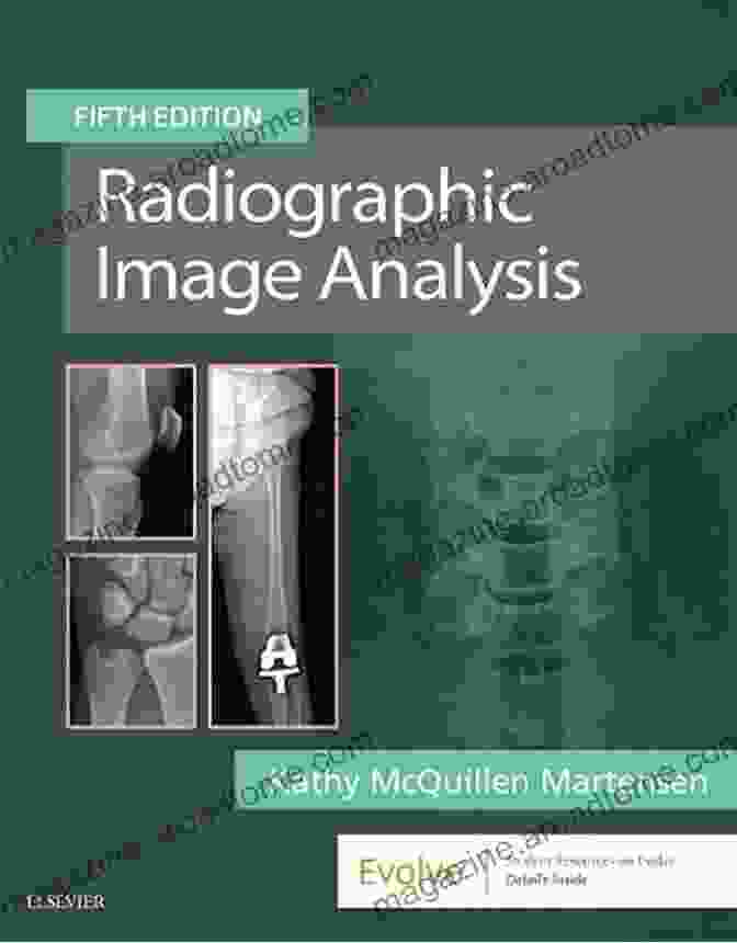 Radiographic Image Analysis Image Quality Radiographic Image Analysis E