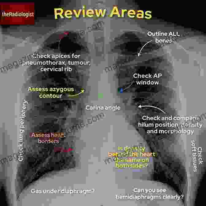 Radiographic Image Analysis Normal Anatomy Radiographic Image Analysis E