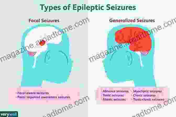 Types Of Epilepsy Seizures Throwing Open The Doors: Considering Meditation S Soothing Effect On Epilepsy