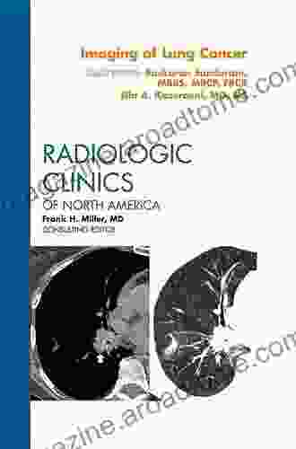 Lung Cancer An Issue Of Radiologic Clinics Of North America (The Clinics: Radiology 56)