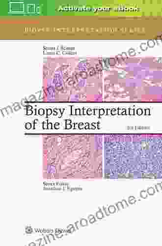 Biopsy Interpretation of the Breast (Biopsy Interpretation Series)