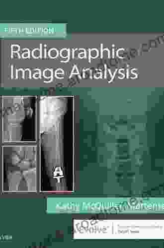 Radiographic Image Analysis E