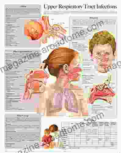 Upper Respiratory Tract Infections e chart: Full illustrated